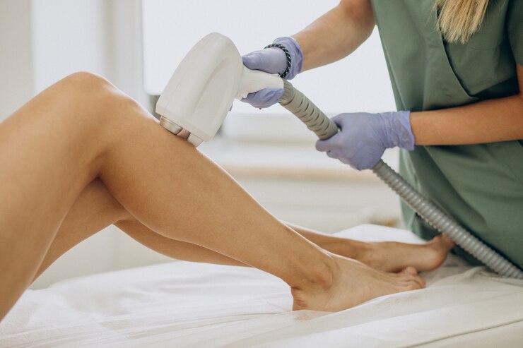 The Ultimate Guide to Laser Hair Removal Treatment