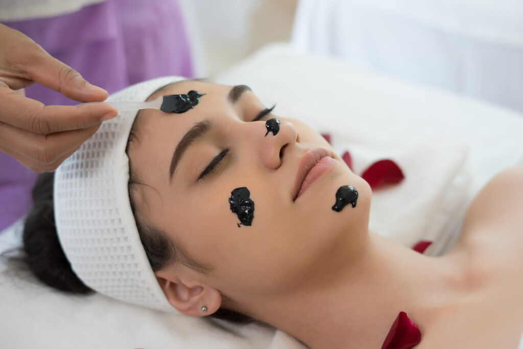 carbon laser facial mohali