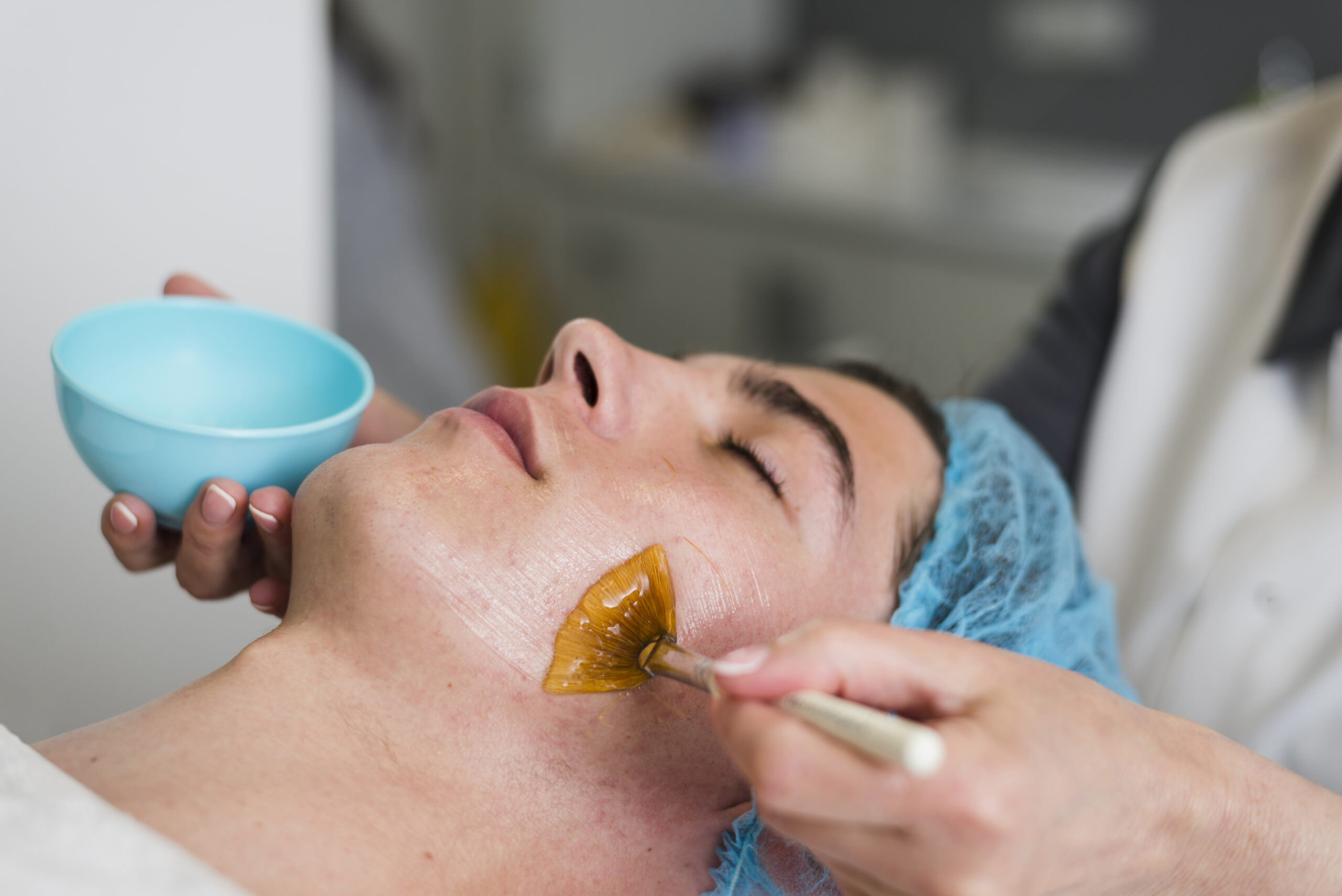 Chemical Peel vs Advanced Facial for Dark Spots in Mohali – Which Is Better?