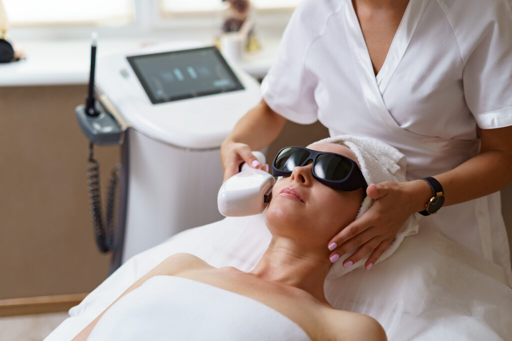 laser treatment for pigmentation