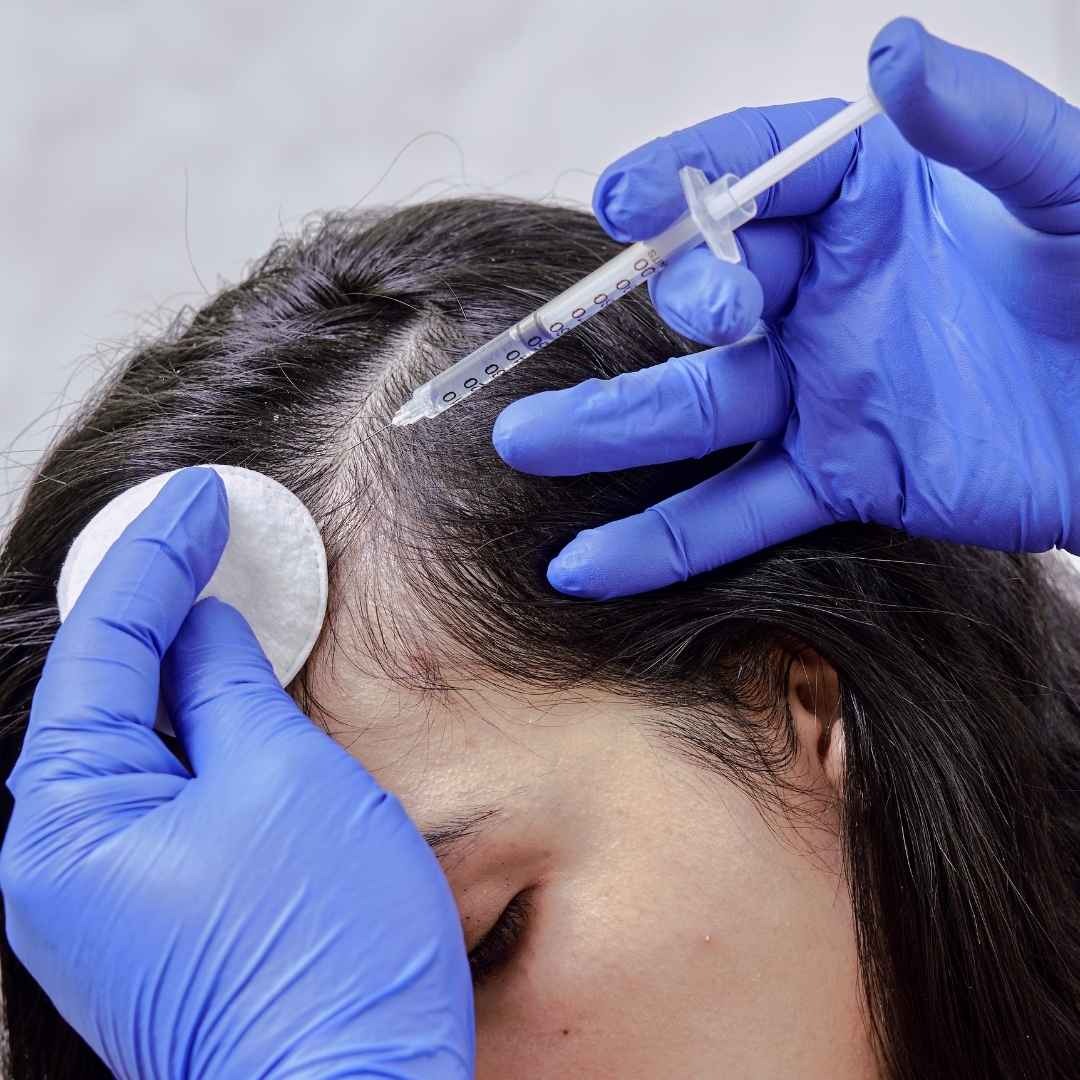 Best Hair Growth Treatment Mohali for Hair Regrowth