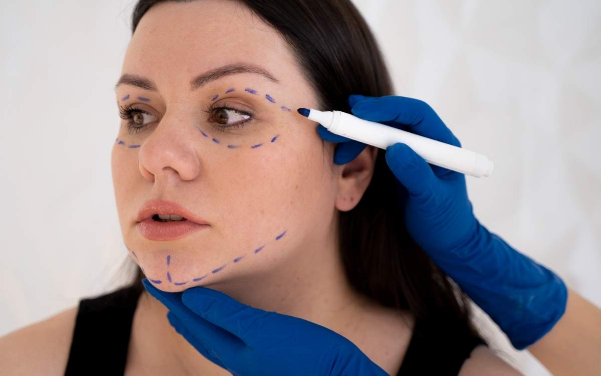 Fine Lines Treatment in Mohali: Restore Youthful Skin with Confidence