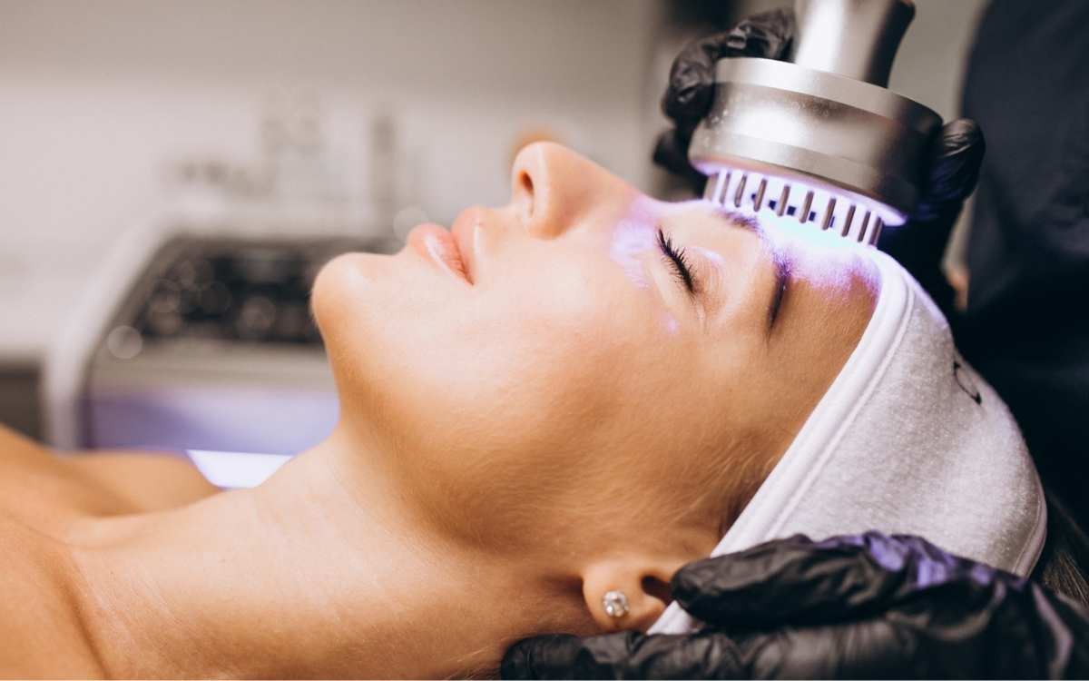 Carbon Laser Facial for Glowing Skin Chandigarh: Your Ultimate Guide to Radiant, Flawless Skin